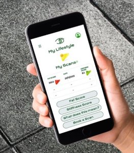 MyLife365 App sdisplayed on phone screen