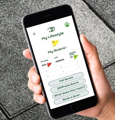 MyLife365 App sdisplayed on phone screen